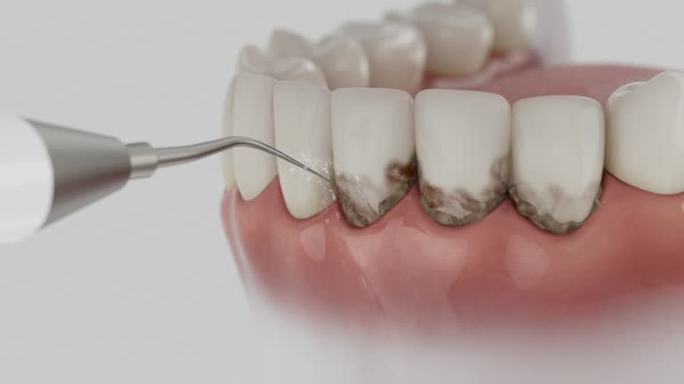 Reliable Dental contractor in Caseyville, IL by Dentist Open Now